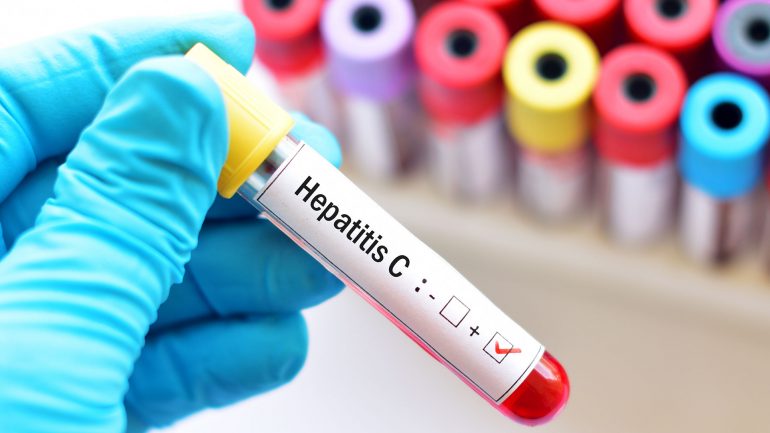 Derogación de patentes abusivas y proteccionistas para fármacos que tratan y curan la Hepatitis-C
